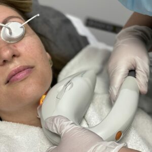 ipl laserbehandeling in enschede