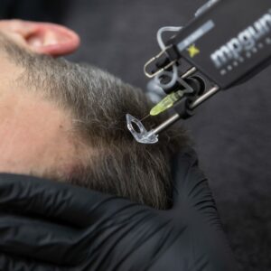 hair xl behandeling