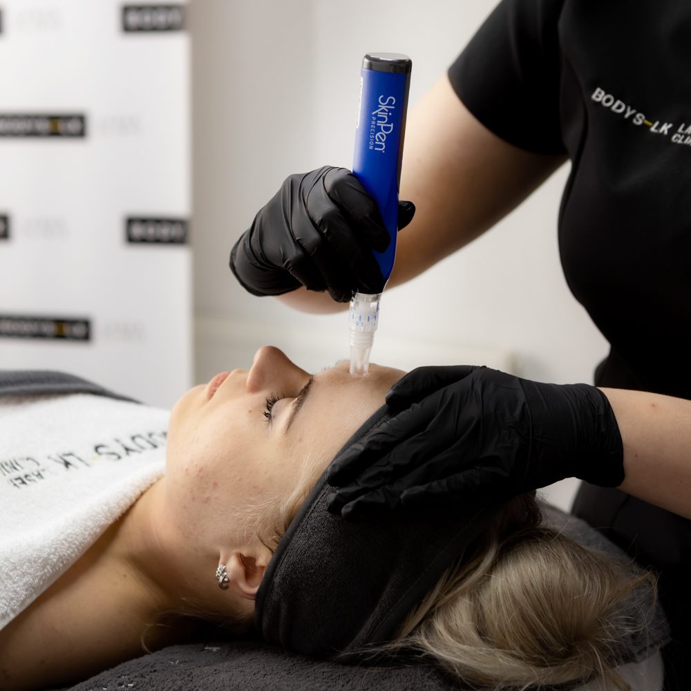 microneedling behandeling enschede